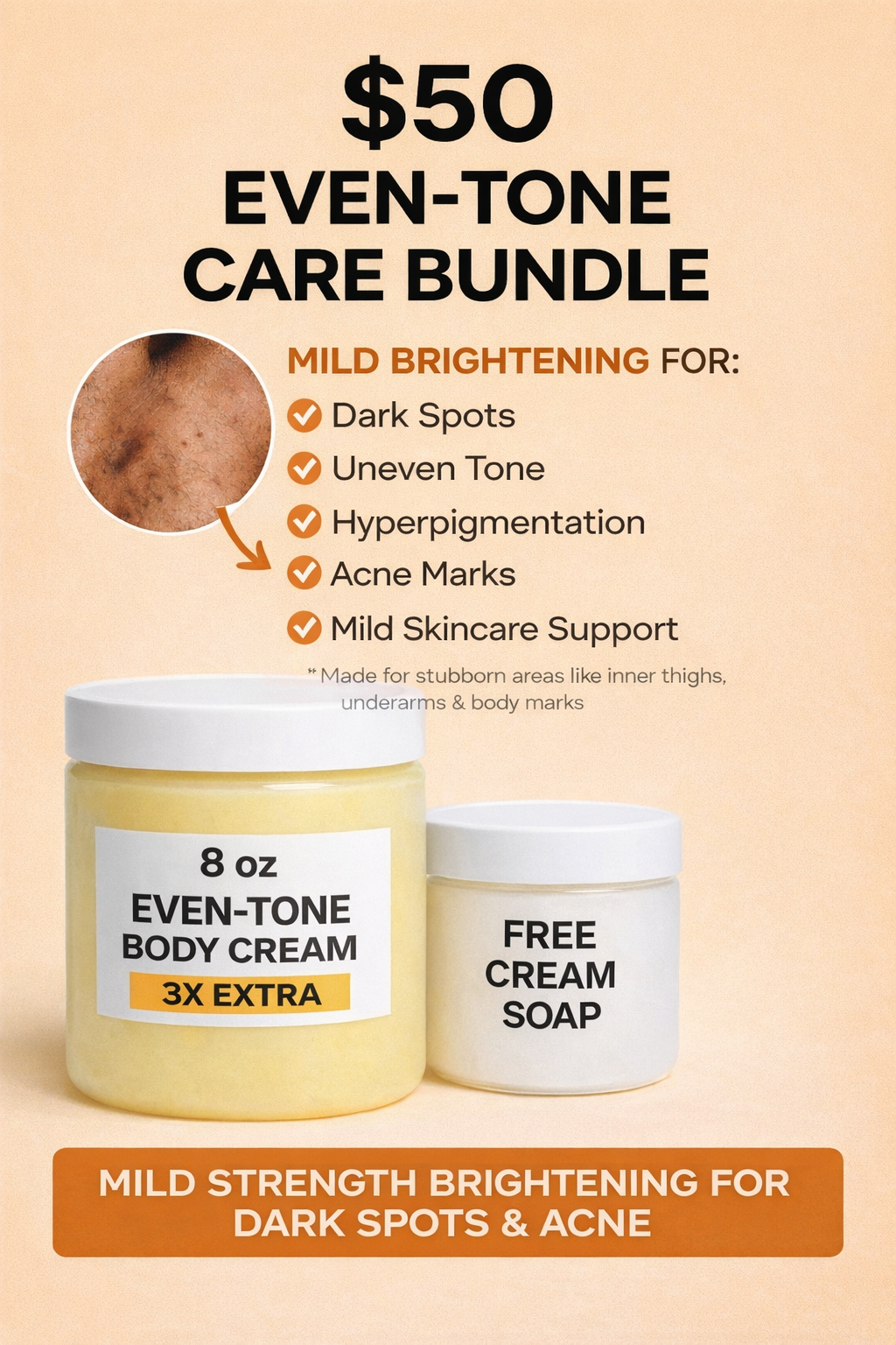 Even-Tone Care Bundle (Mild Strength) – Dark Spot, Acne Mark & Hyperpigmentation Brightening Set + Free Cream Soap