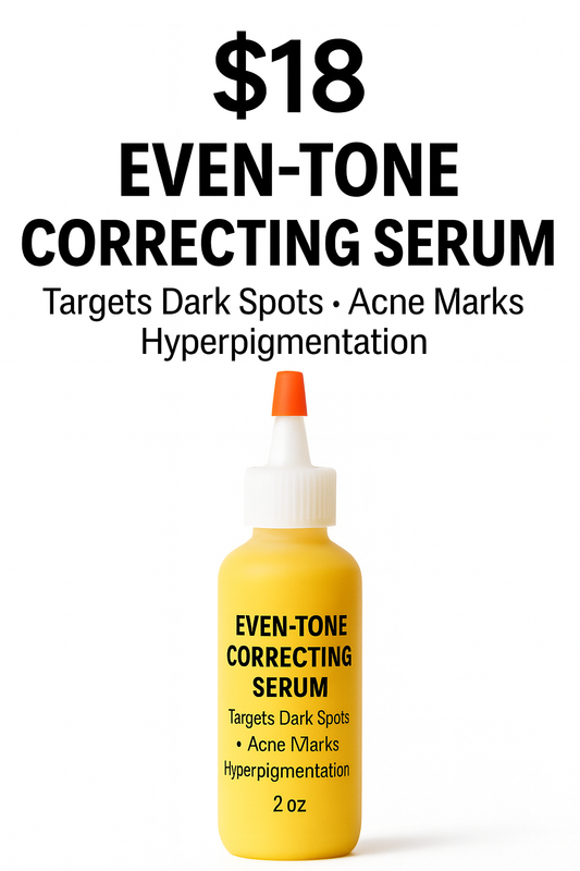 Even-Tone Correcting Serum – Targets Dark Spots, Acne Marks & Hyperpigmentation (2 oz)