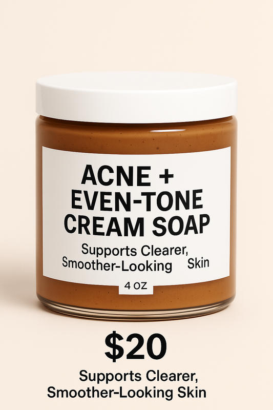 Acne + Even-Tone Cream Soap – Supports Clear, Smooth-Looking Skin (4 oz)
