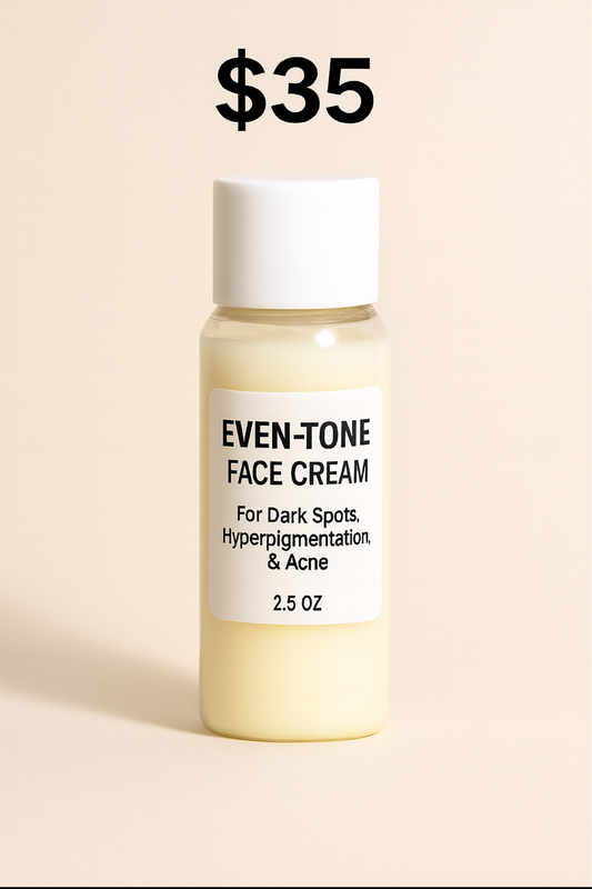 Even-Tone Face Cream – Targets Dark Spots, Hyperpigmentation & Acne (2.5 oz)